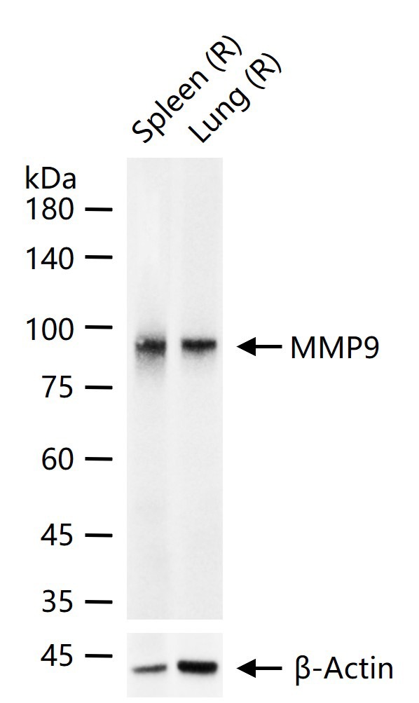 Anti-MMP-9 Antibody (3R987)