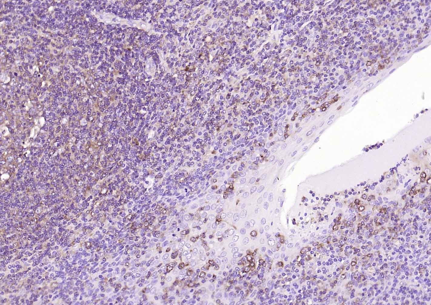 Anti-MRC1 Antibody (6S133)