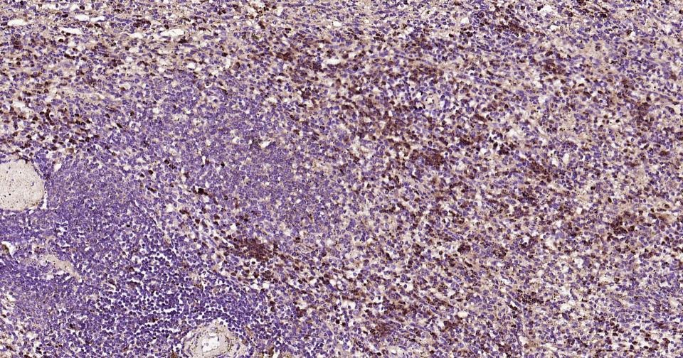 Anti-MMP-9 Polyclonal Antibody 3