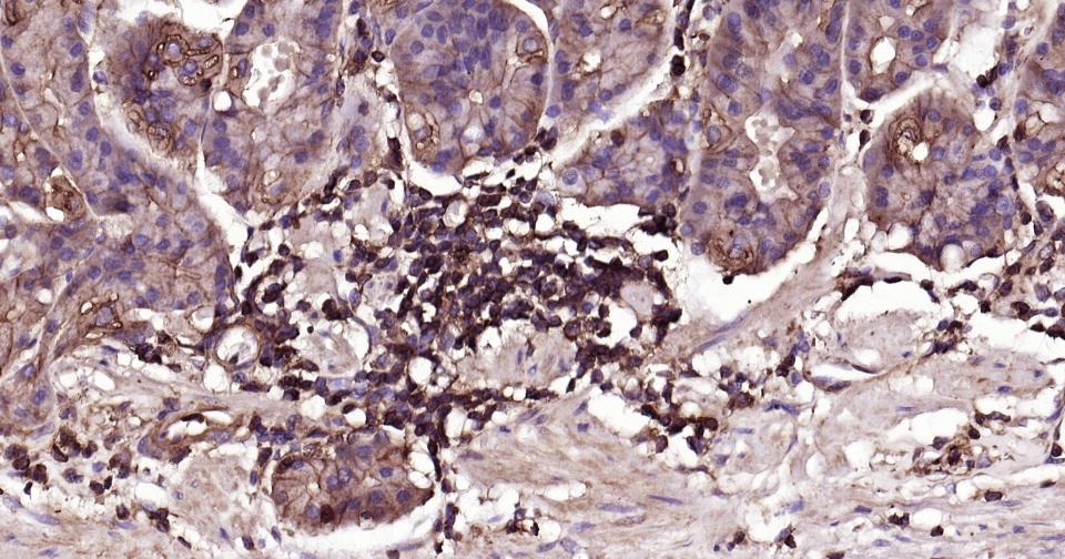 Anti-MRC1 Antibody (6S133)