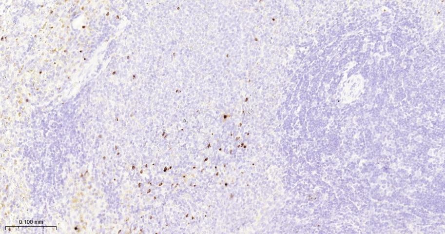 Anti-MMP-9 Antibody (3R987)