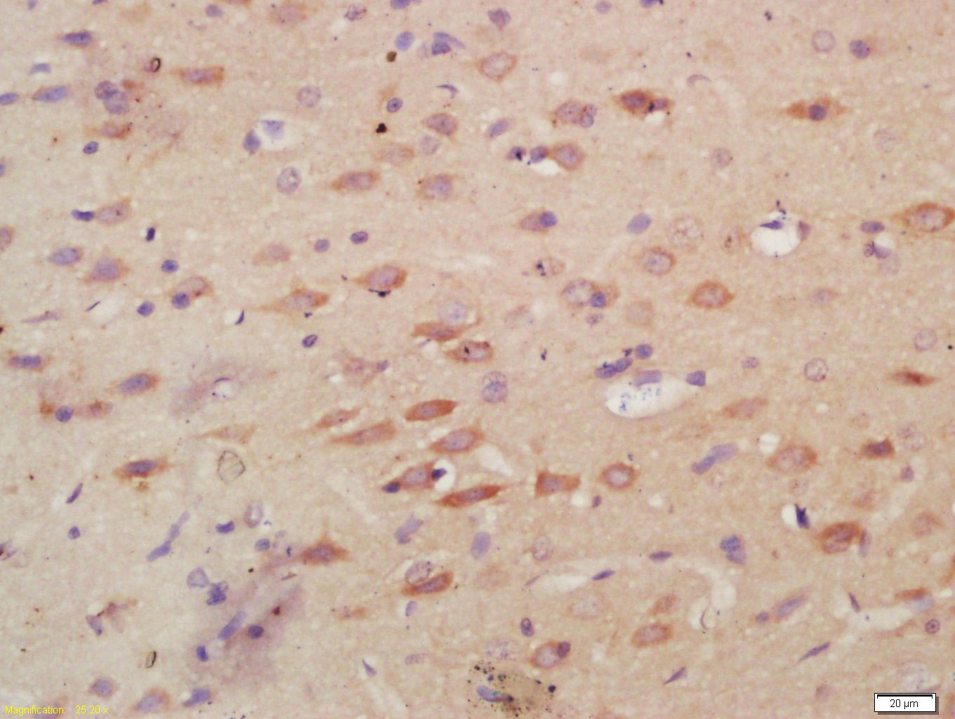 Anti-MPO Polyclonal Antibody 2