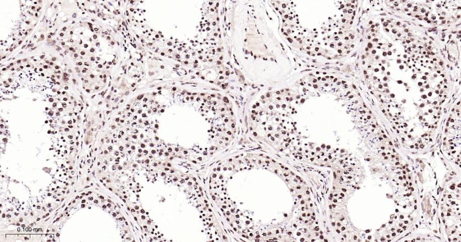 Anti-NUMA1 Antibody (6H53)