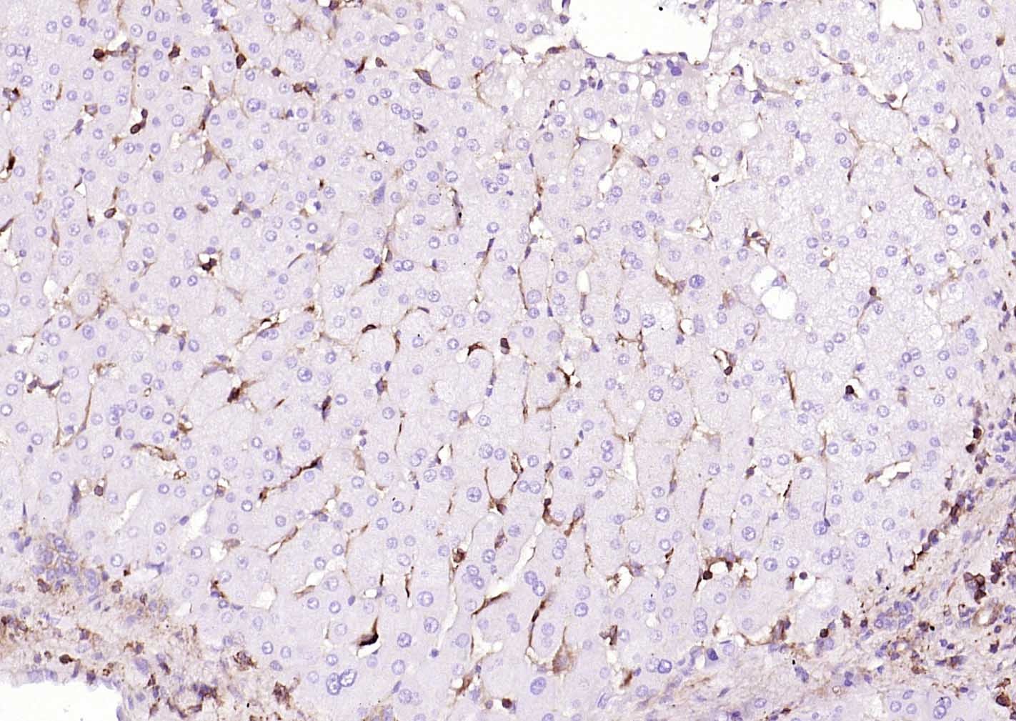 Anti-MRC1 Antibody (6S133)