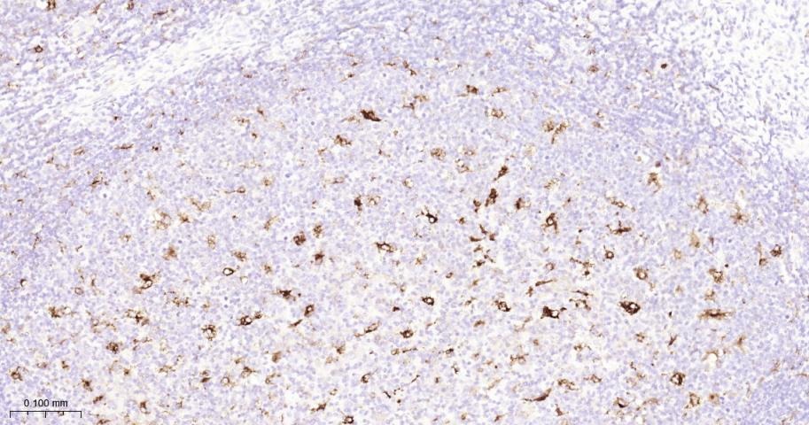 Anti-MMP-9 Antibody (3R987)