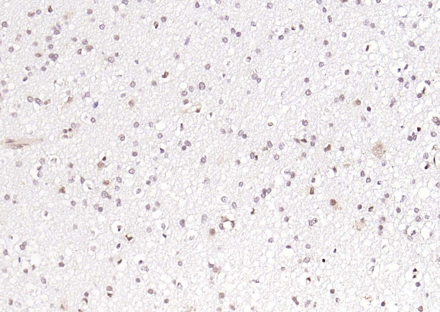 Anti-OIT3 Polyclonal Antibody