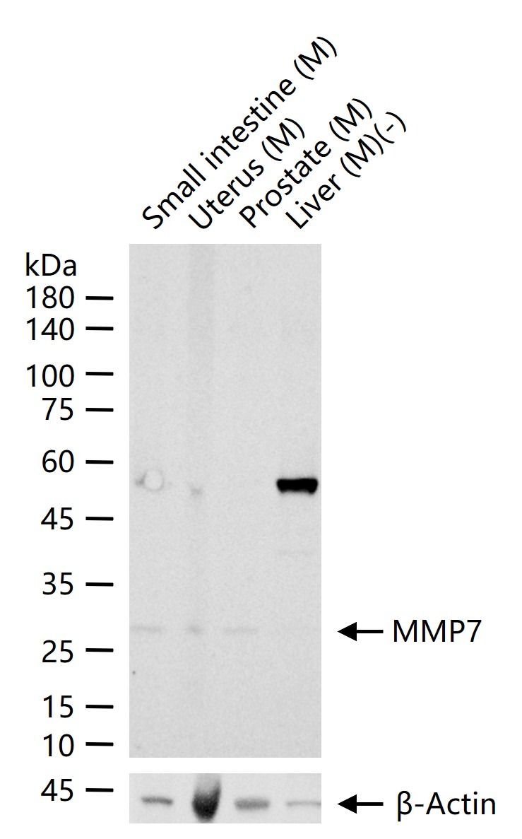 Anti-MMP-7 Polyclonal Antibody