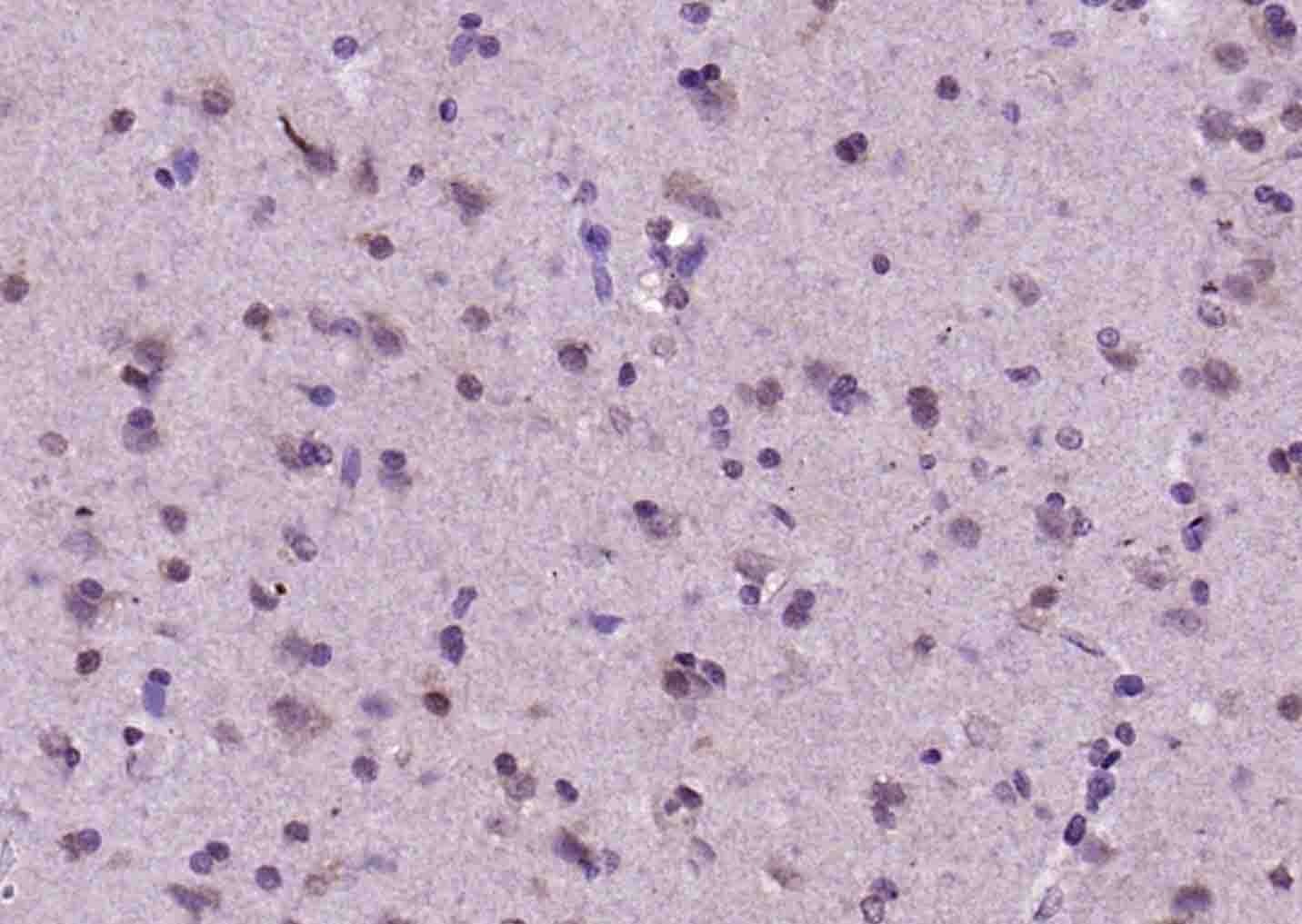 Anti-Olig-1/Oligo1 Polyclonal Antibody