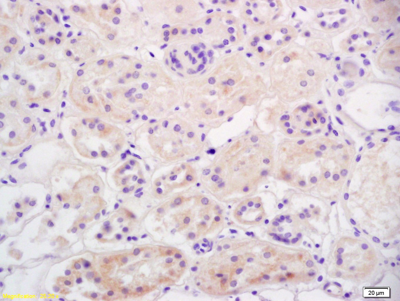 Anti-OAT-1 Polyclonal Antibody