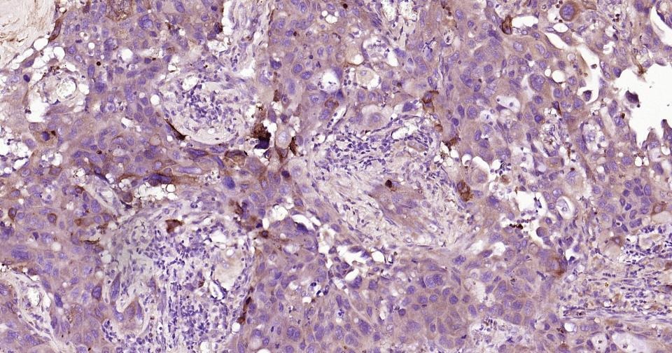 Anti-MMP-9 Polyclonal Antibody 3