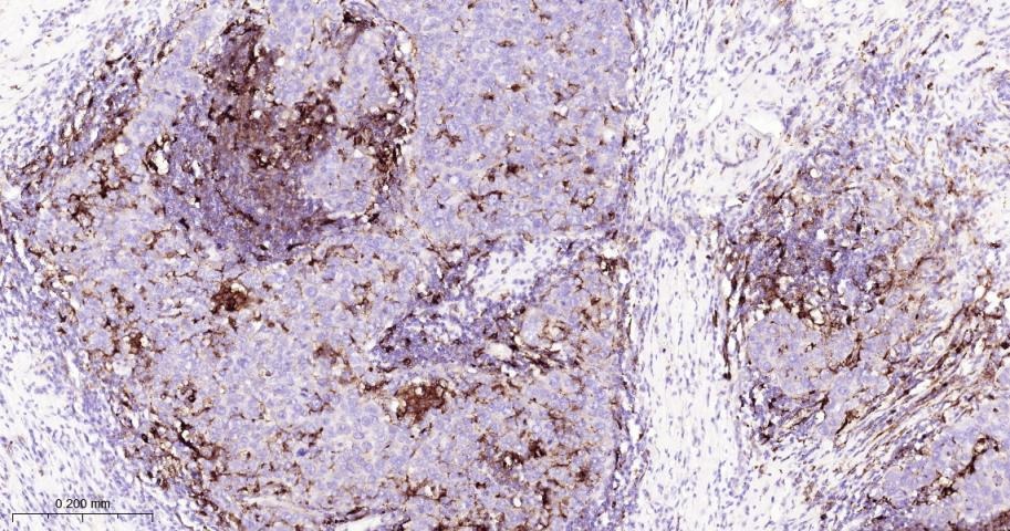 Anti-MMP-9 Antibody (3R987)