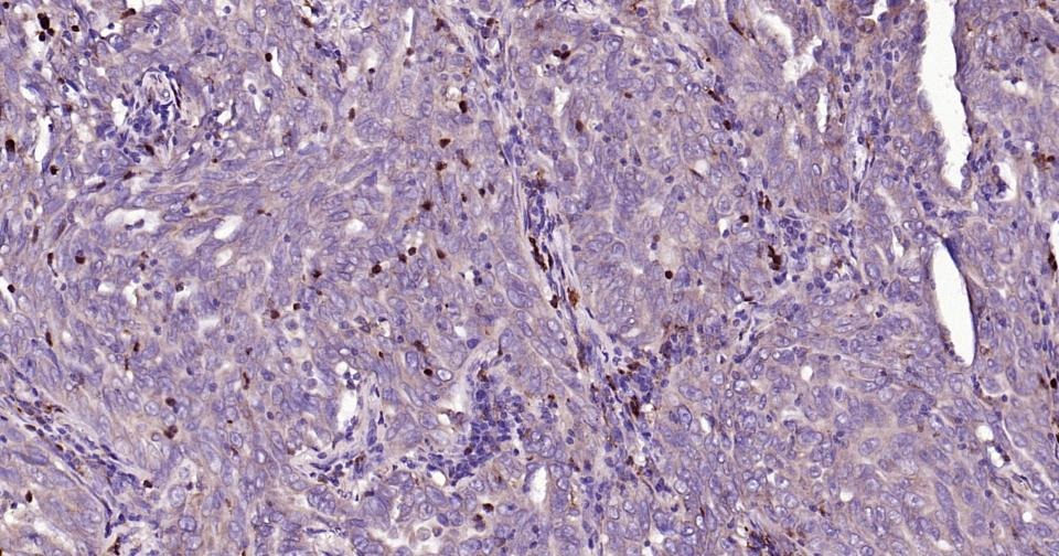 Anti-MMP-9 Antibody (3R987)