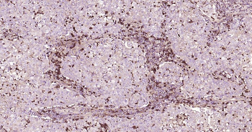 Anti-MMP-9 Polyclonal Antibody 3