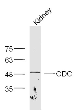 Anti-ODC1 Polyclonal Antibody