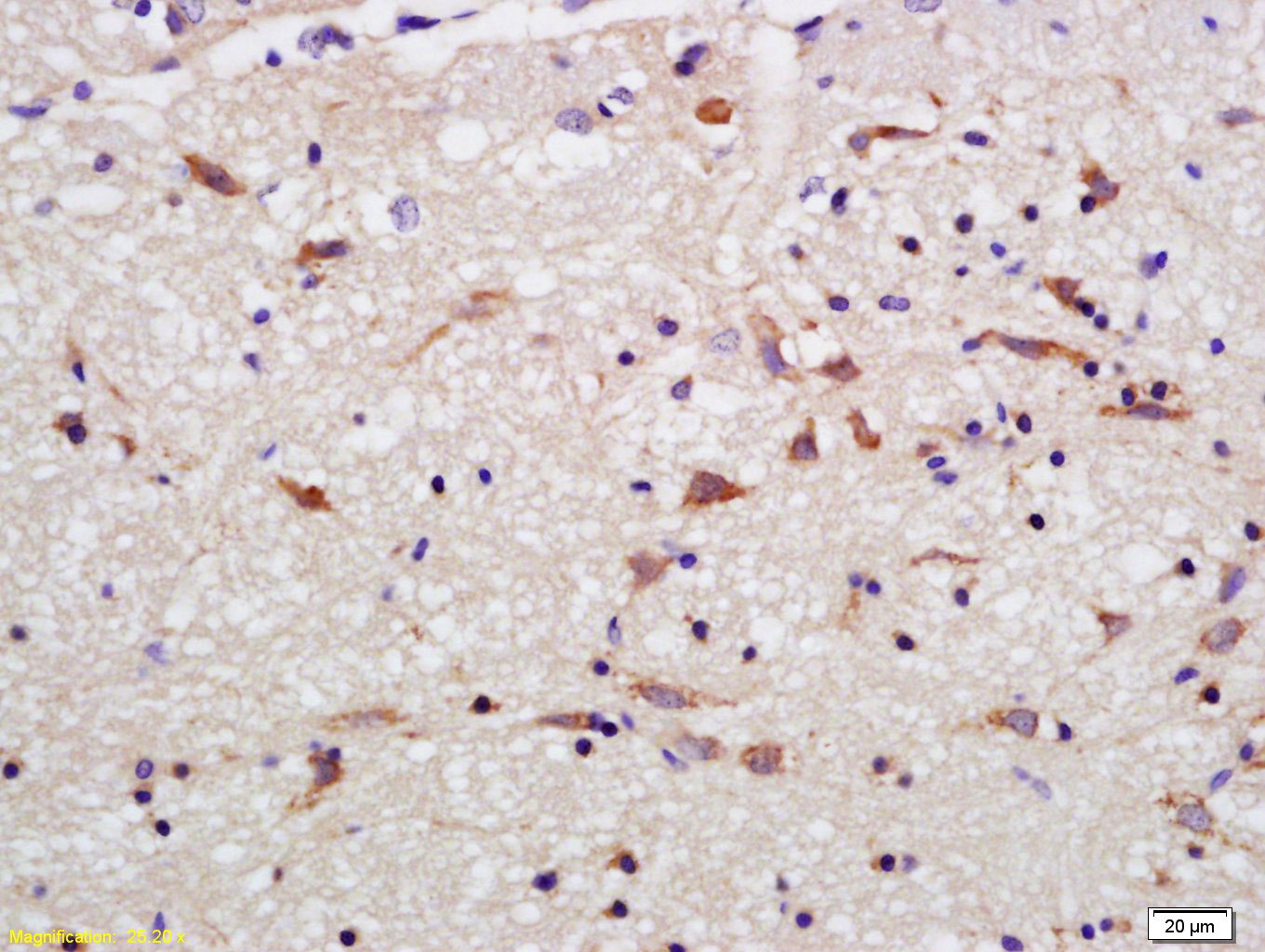 Anti-OPA1 Polyclonal Antibody