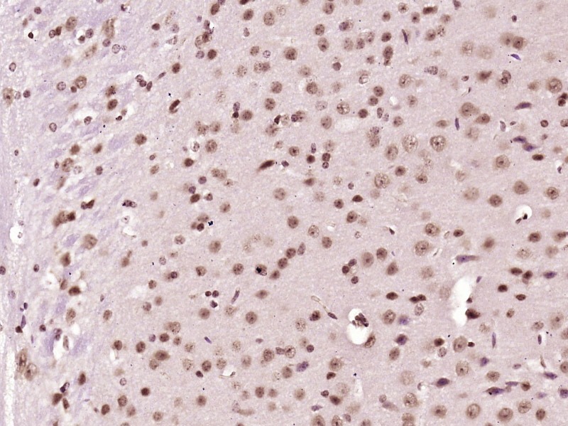 Anti-NOX4 Polyclonal Antibody