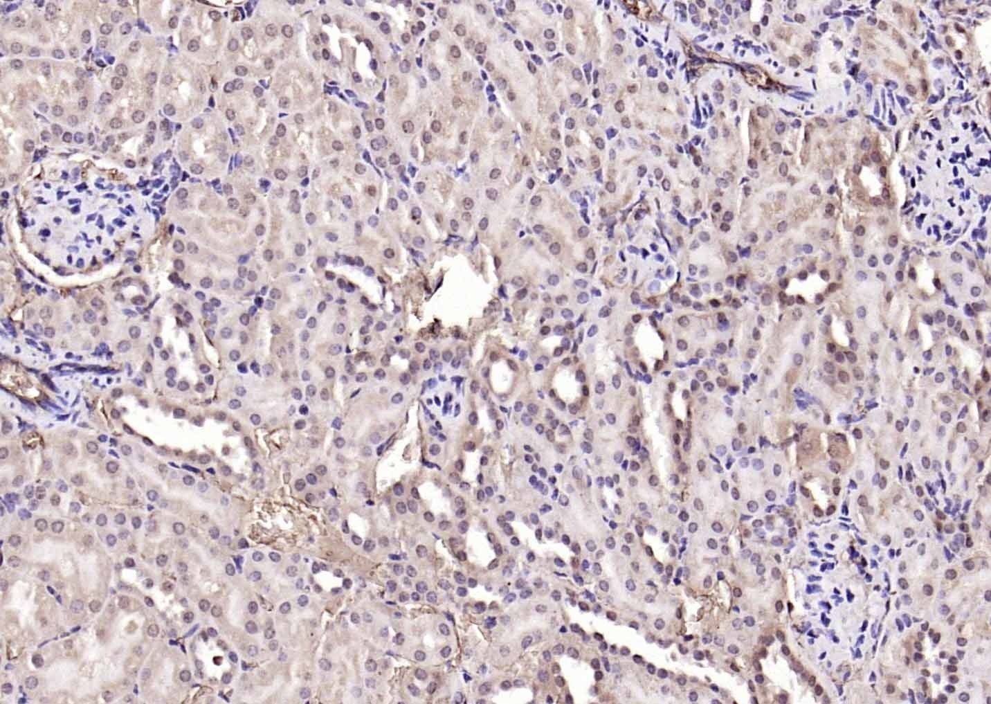Anti-NOX4 Polyclonal Antibody