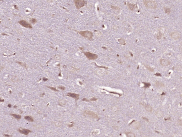Anti-OPRM1 Polyclonal Antibody