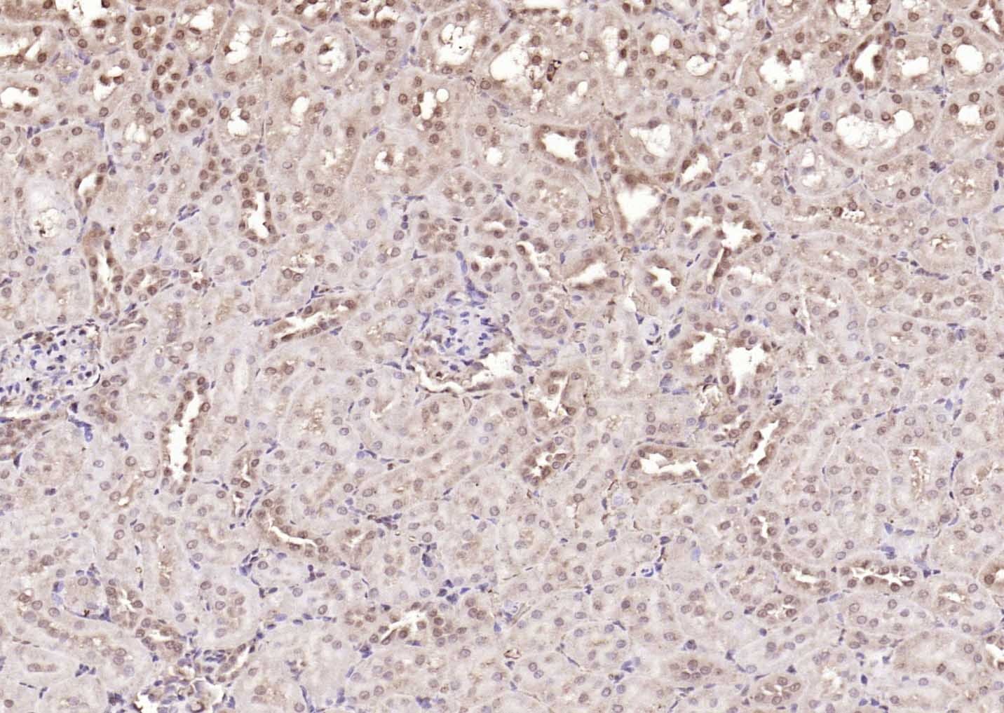 Anti-NOX4 Polyclonal Antibody