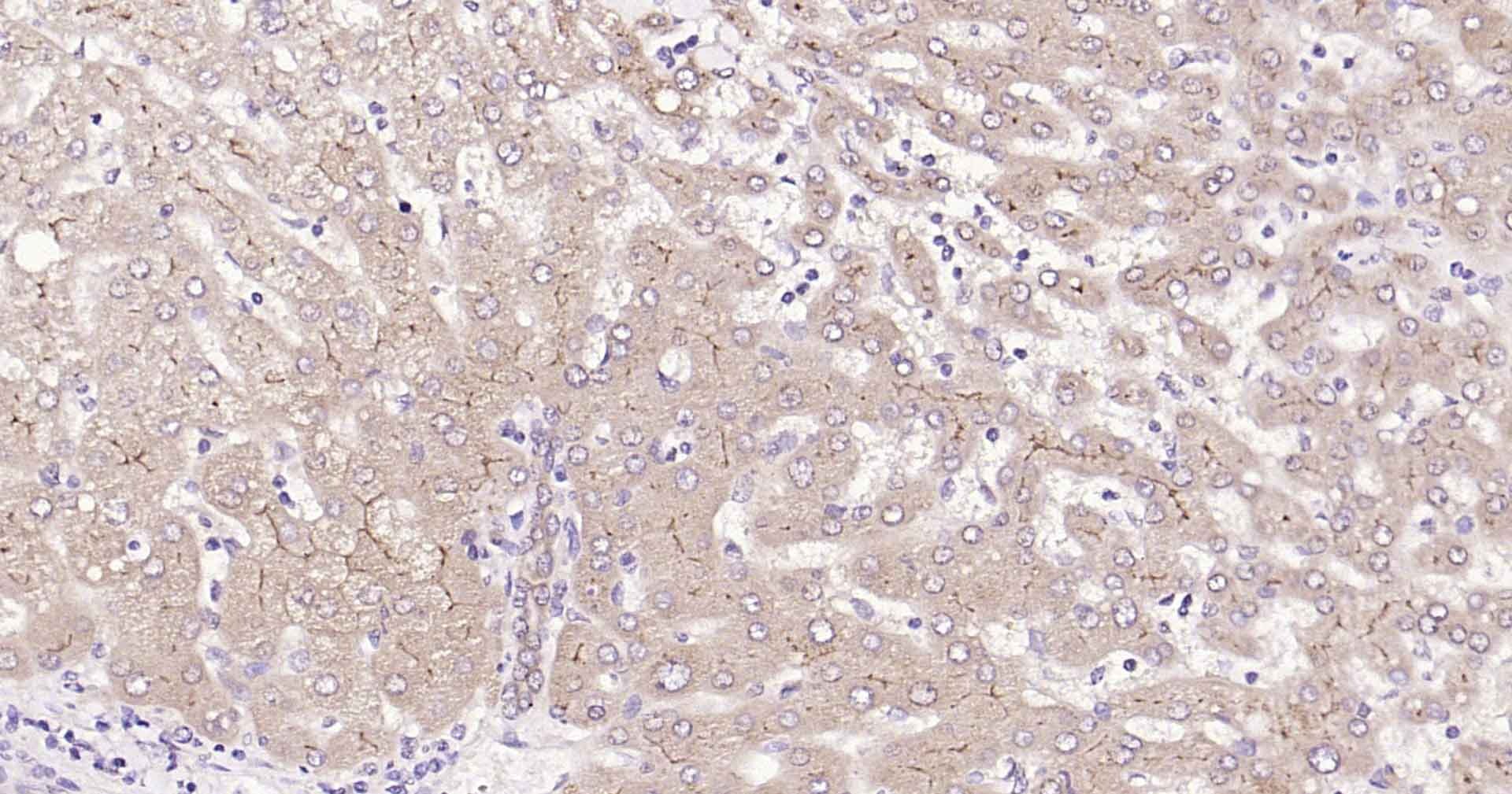 Anti-MRP2/ABCC2 Polyclonal Antibody