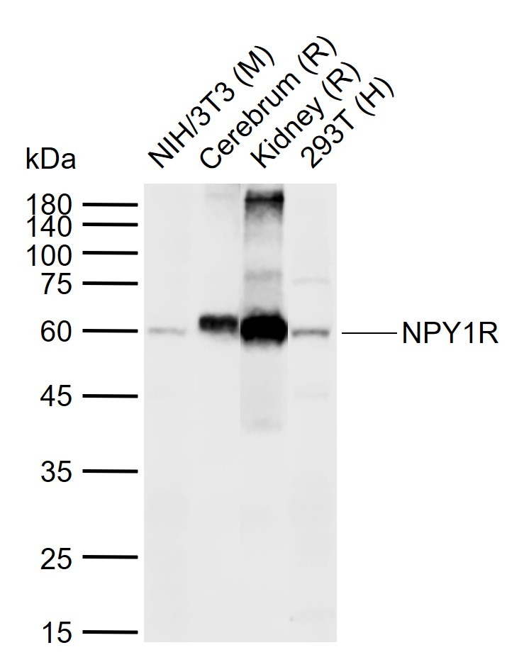 Anti-NPY1R Polyclonal Antibody
