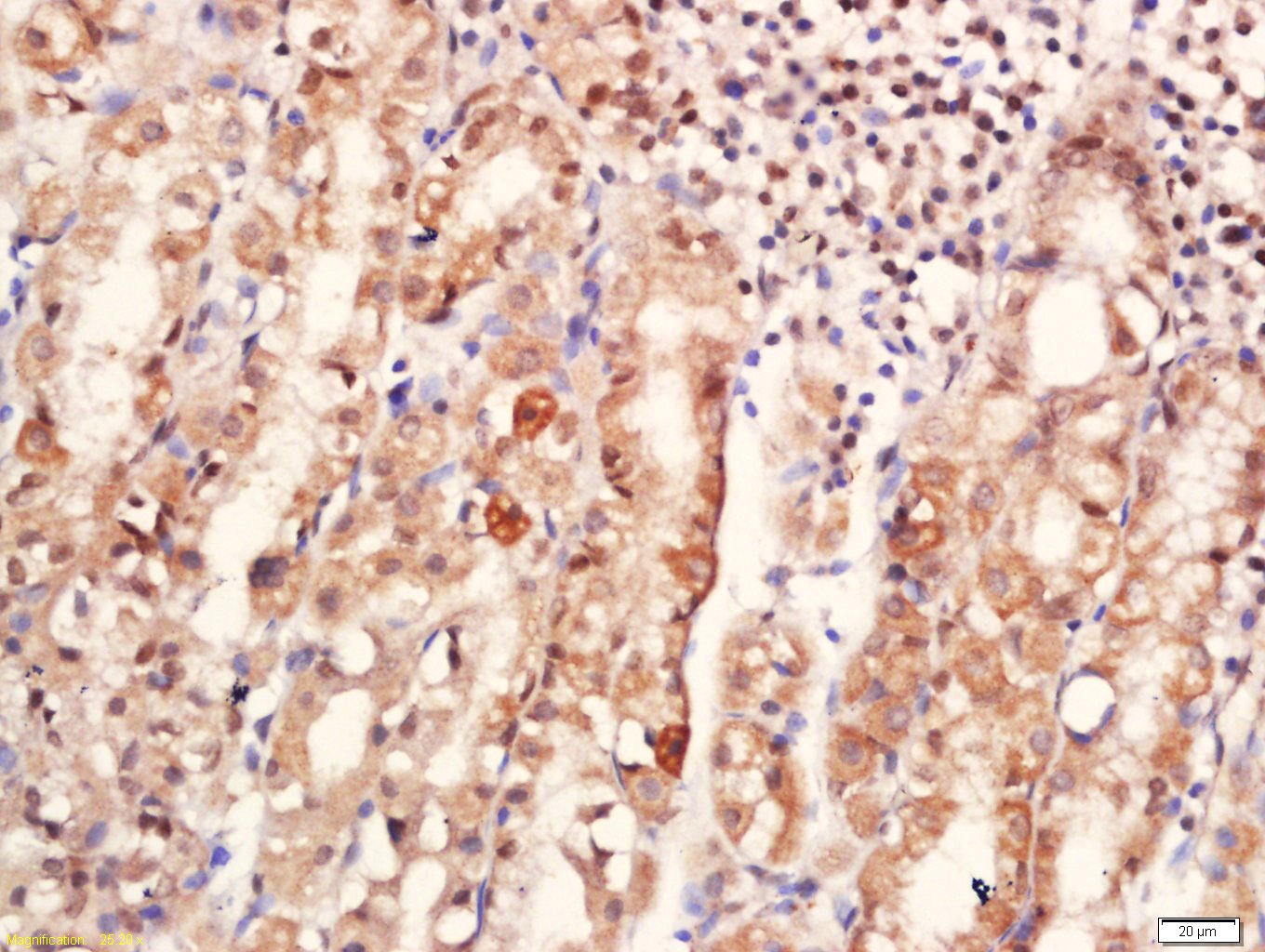 Anti-Notch 1 Polyclonal Antibody