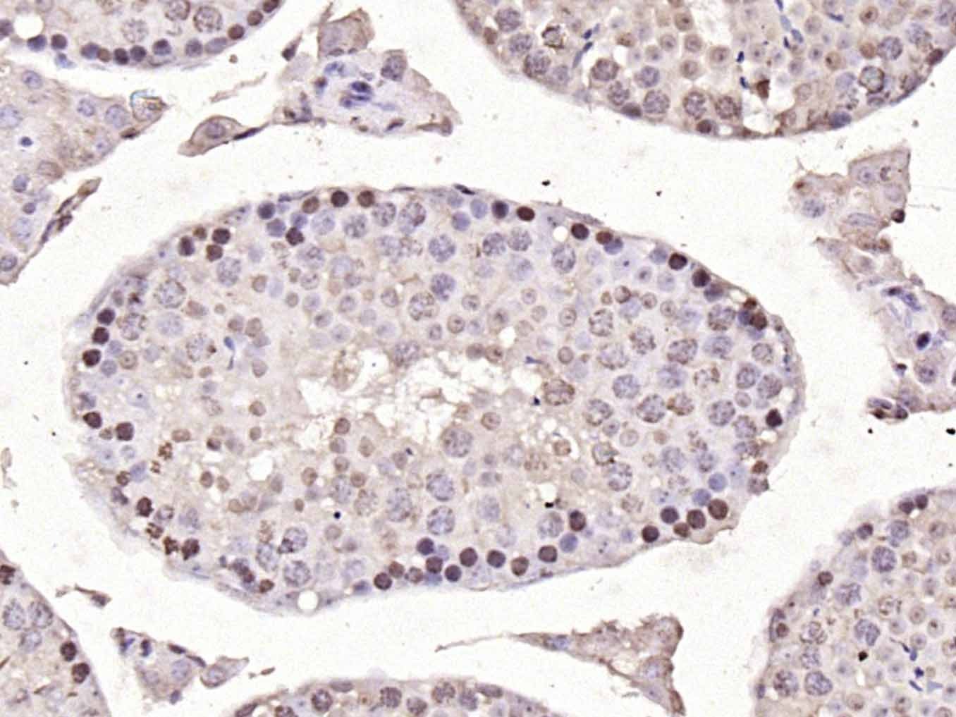 Anti-Notch 1 Polyclonal Antibody