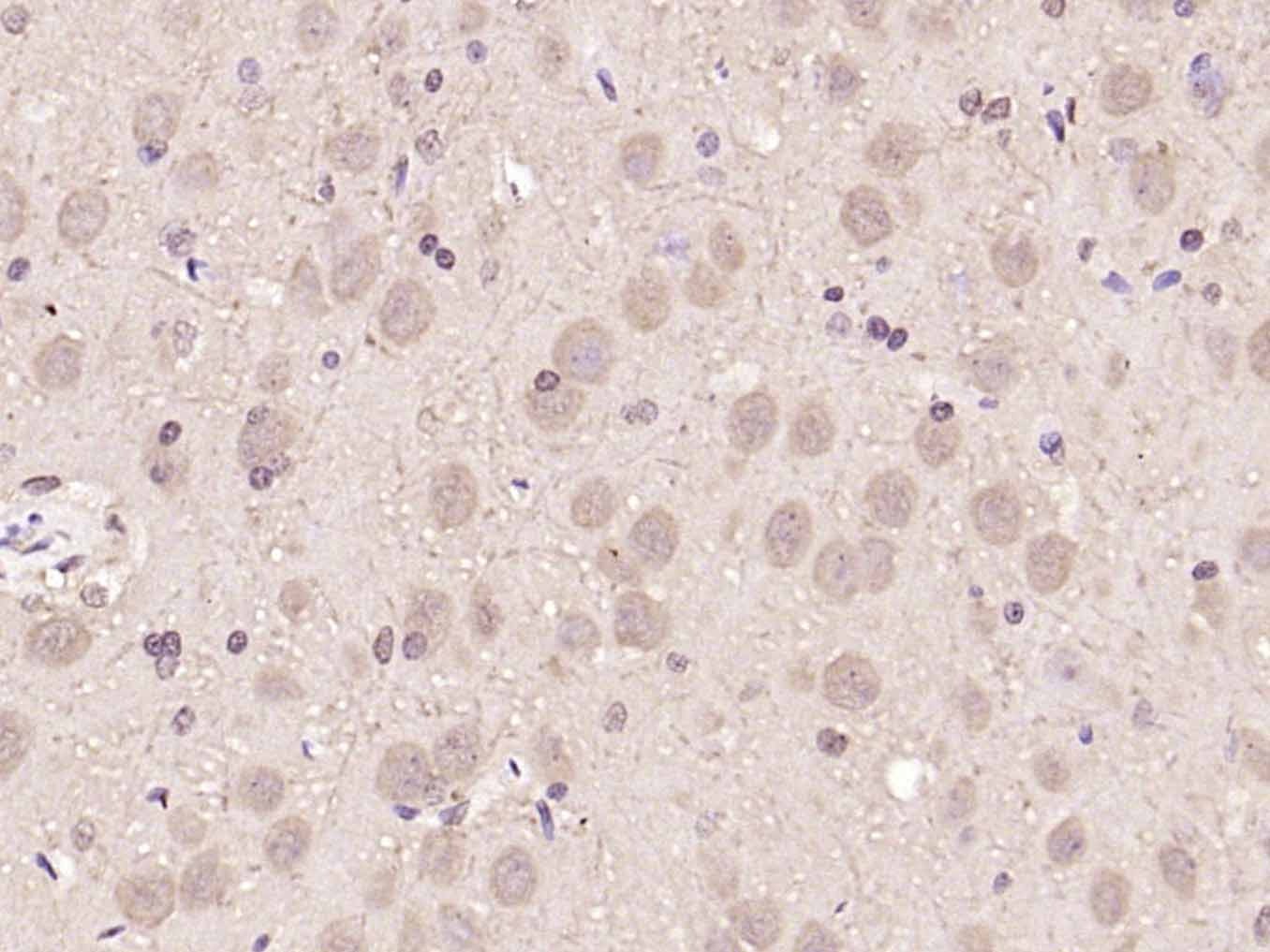 Anti-Notch 1 Polyclonal Antibody