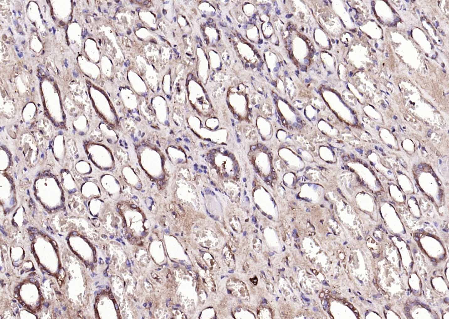 Anti-NOX4 Polyclonal Antibody