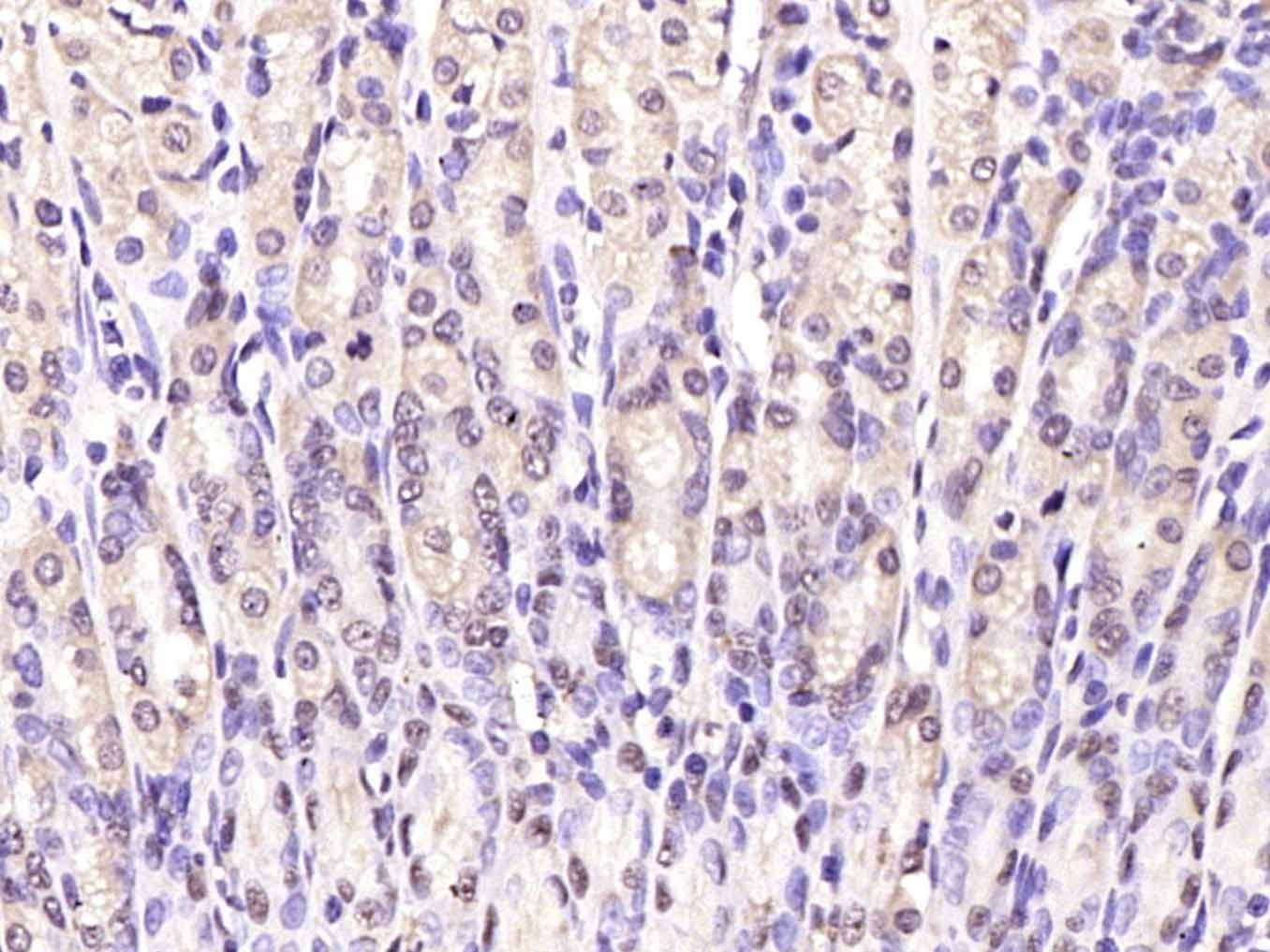 Anti-Notch 1 Polyclonal Antibody