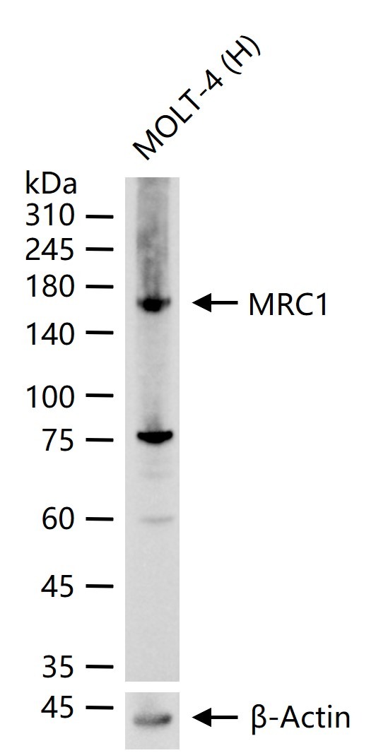 Anti-MRC1 Antibody (6P560)