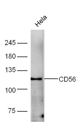 Anti-NCAM1 Polyclonal Antibody