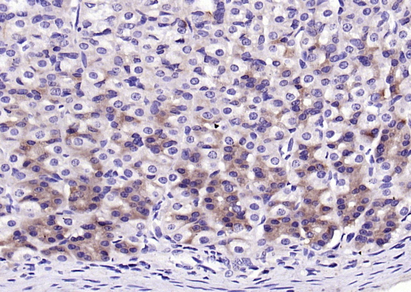 Anti-NQO1 Polyclonal Antibody