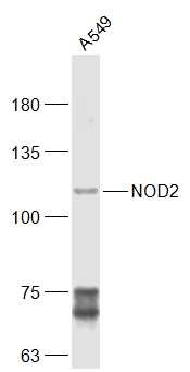 Anti-NOD2 Polyclonal Antibody