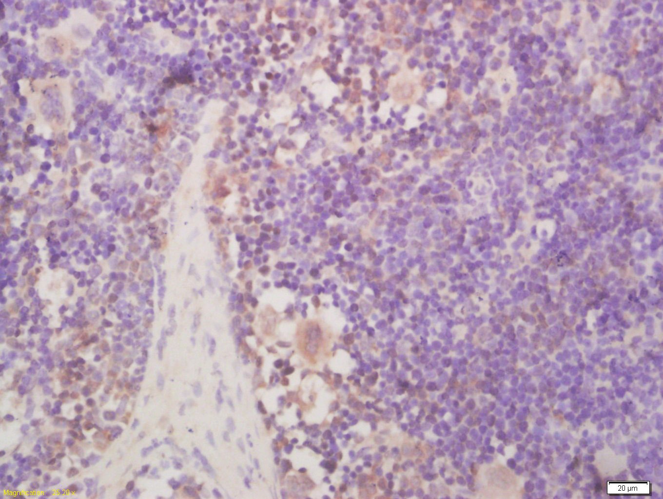 Anti-NR0B2 Polyclonal Antibody