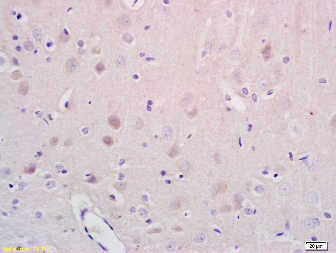 Anti-NR1D1 Polyclonal Antibody