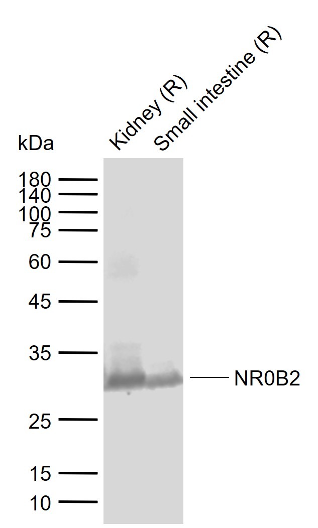 Anti-NR0B2 Polyclonal Antibody