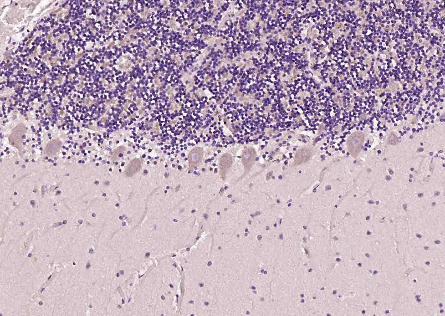 Anti-OPRM1 Polyclonal Antibody