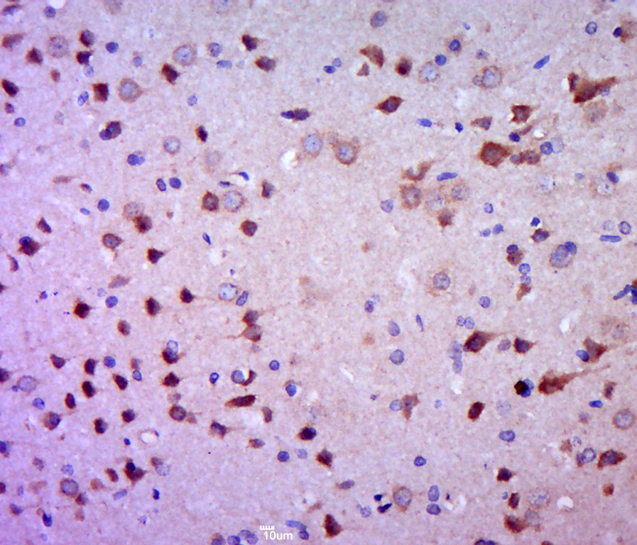 Anti-NR3C1 Polyclonal Antibody