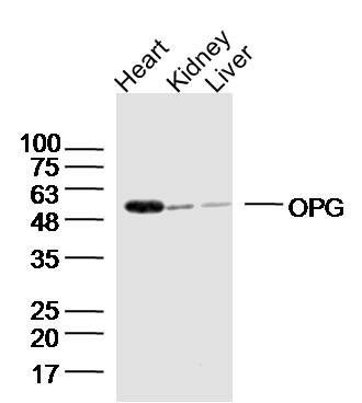 Anti-Osteoprotegerin Polyclonal Antibody
