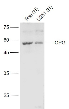 Anti-Osteoprotegerin Polyclonal Antibody