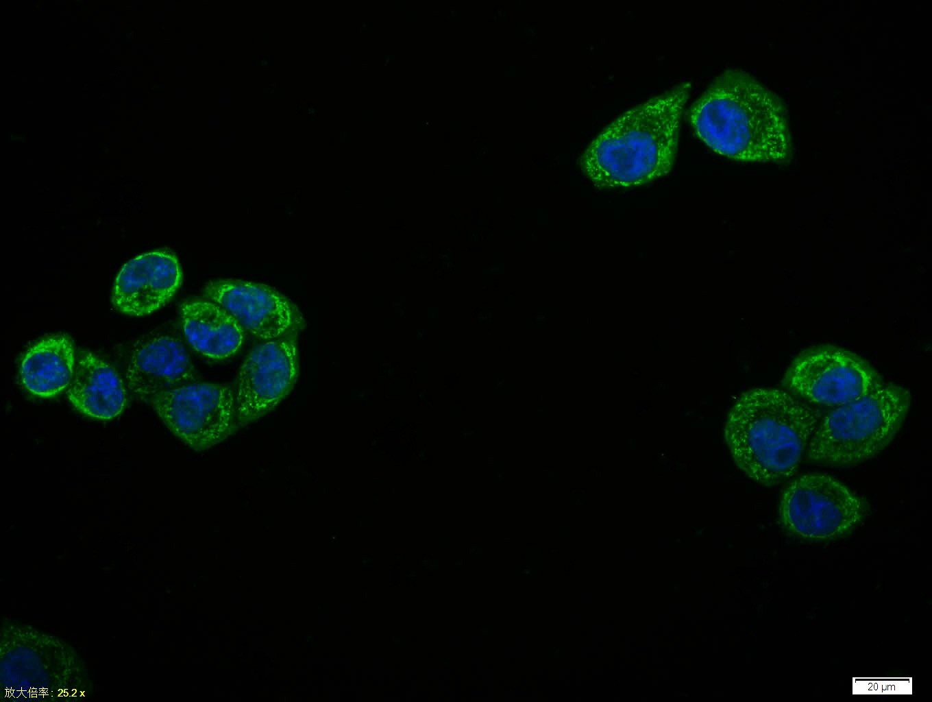 Anti-Phospho-NF-kB p65 (Thr435) Polyclonal Antibody