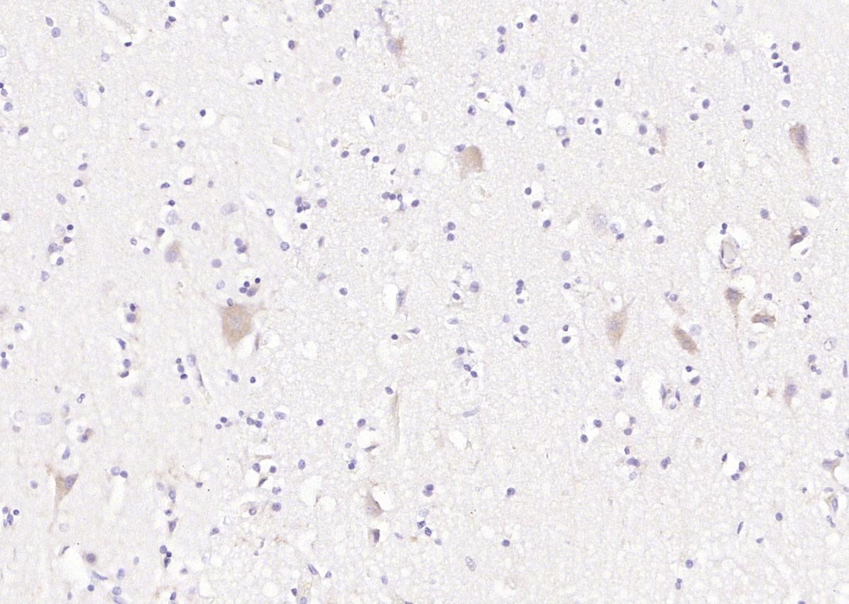 Anti-Phospho-SMAD7 (Ser249) Polyclonal Antibody