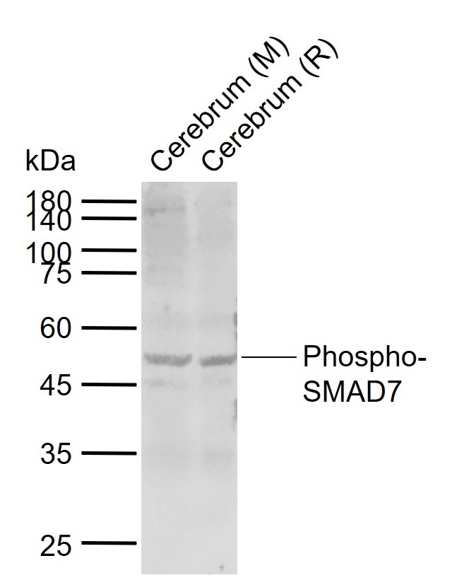 Anti-Phospho-SMAD7 (Ser249) Polyclonal Antibody