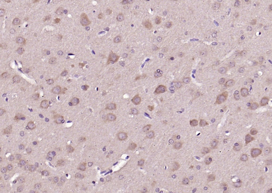 Anti-Phospho-P38 MAPK (Thr180) Polyclonal Antibody
