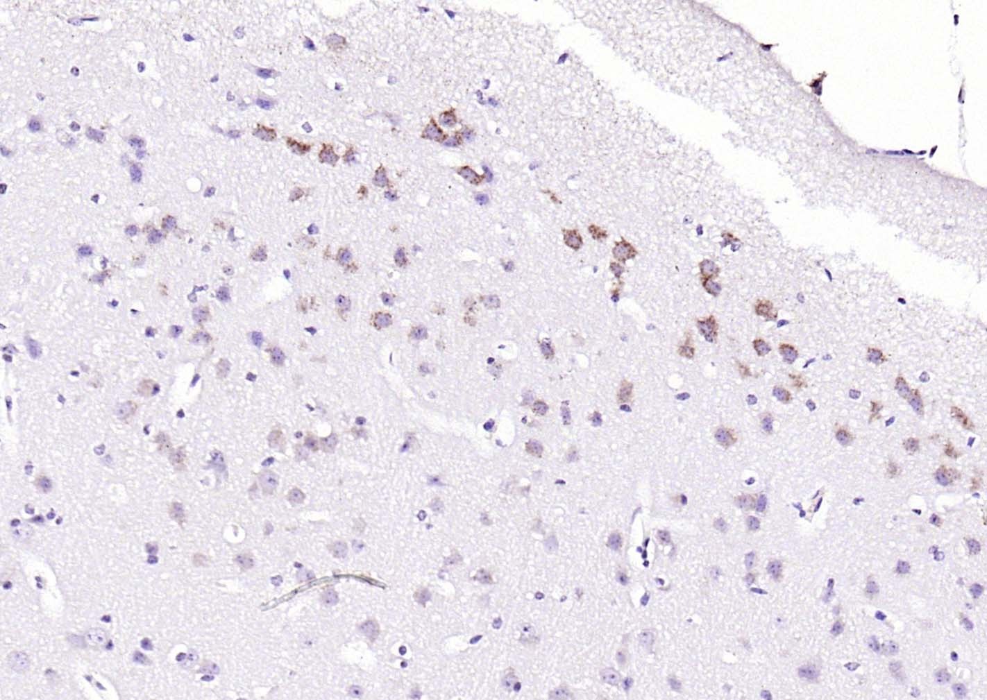 Anti-Phospho-PERK (Thr980) Polyclonal Antibody