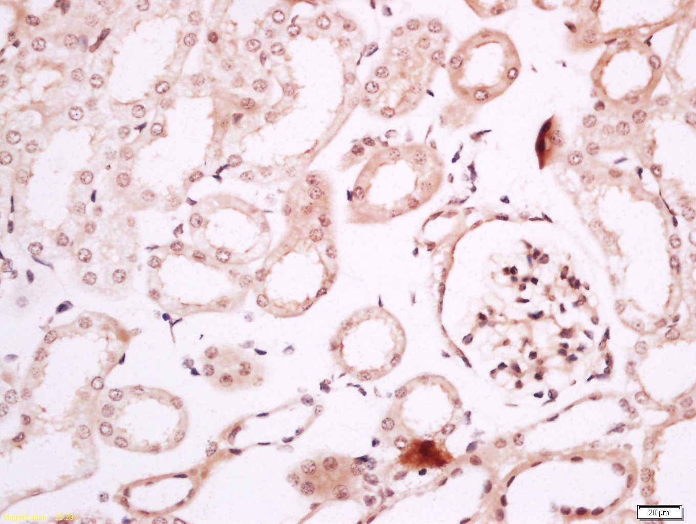 Anti-Phospho-p53 (Ser15) Polyclonal Antibody