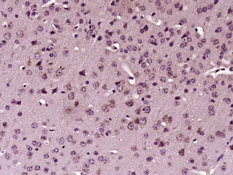 Anti-Phospho-STAT1 (Tyr701) Polyclonal Antibody