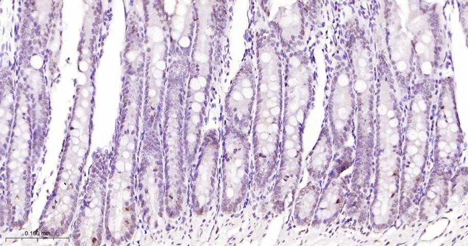 Anti-Phospho-STAT3 (Tyr705) Antibody (2J657)