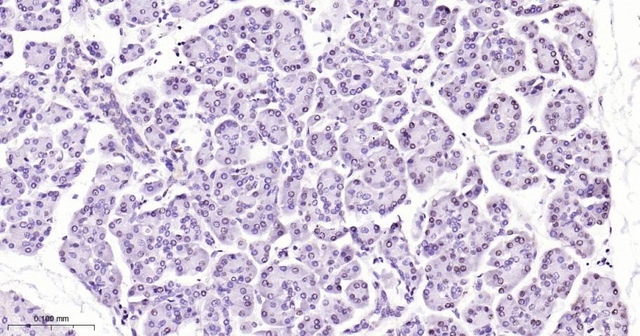 Anti-Phospho-STAT3 (Tyr705) Antibody (2J657)